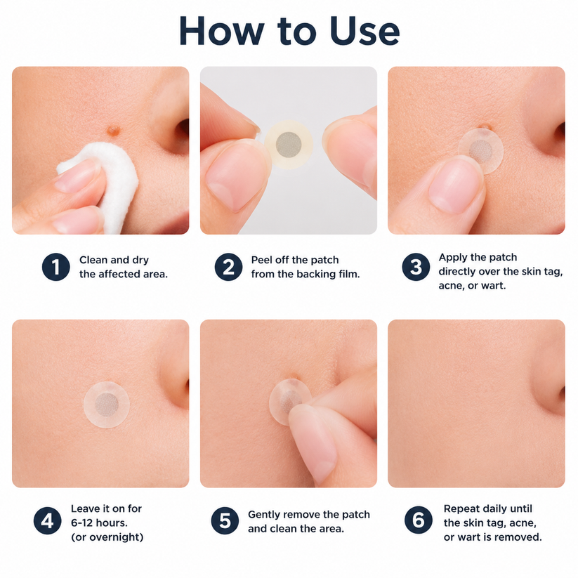 How to use the skin patch